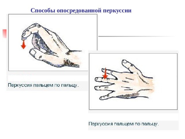 Способы опосредованной перкуссии 