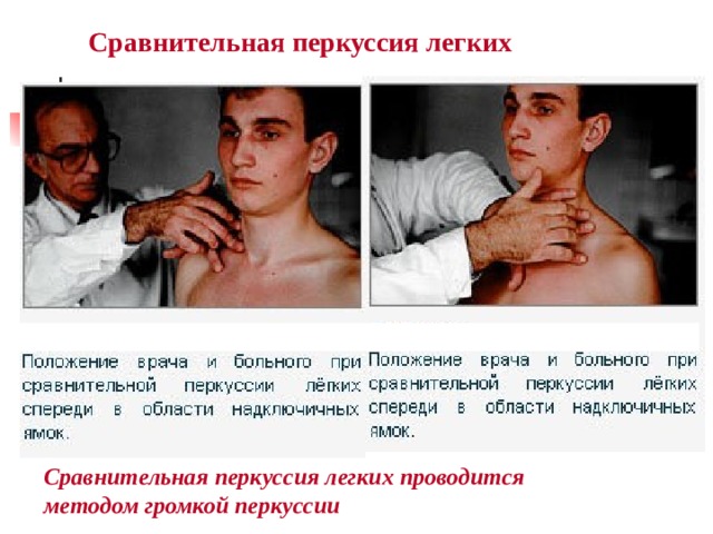 Сравнительная перкуссия легких Сравнительная перкуссия легких проводится методом громкой перкуссии 