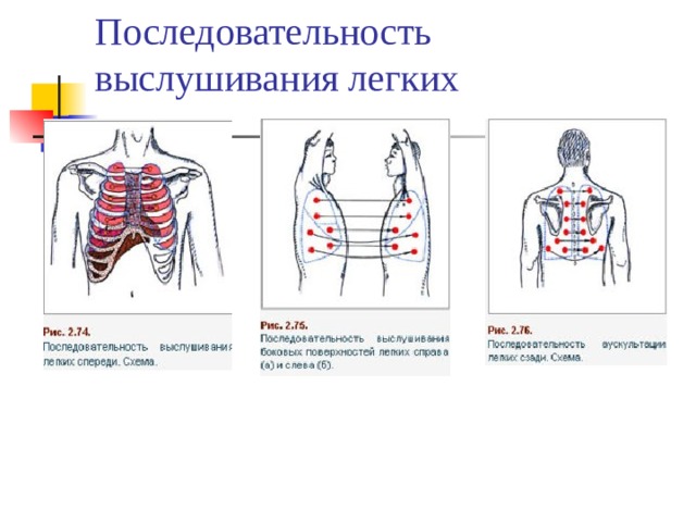Последовательность выслушивания легких 