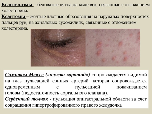 Методика диагностики заболеваний ССС