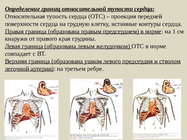 Границы относительной тупости сердца