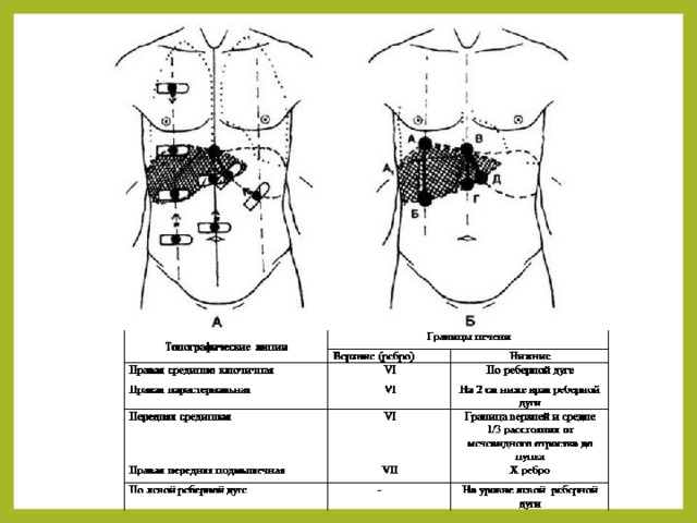 Схема постановки пиявок на печень