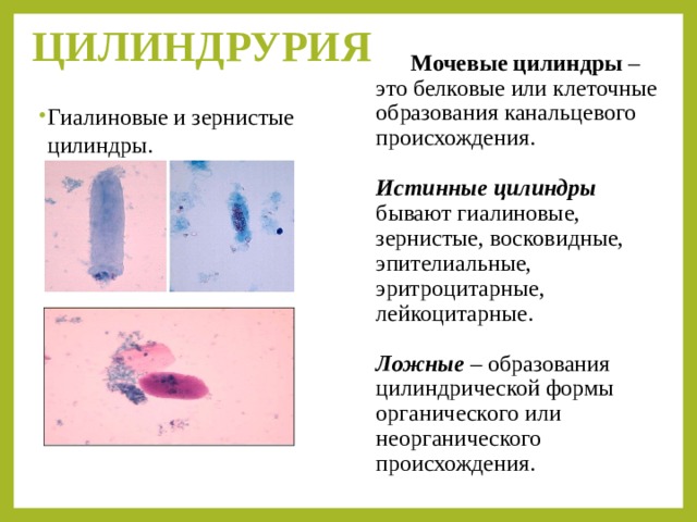 Цилиндрурия характерна. Цилиндрурия при цистите. Цилиндрурия наиболее характерна для:. Эритроцитарные цилиндры образуются при. Цилиндрурия виды норма.