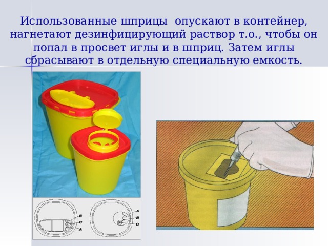 Использованные шприцы опускают в контейнер, нагнетают дезинфицирующий раствор т.о., чтобы он попал в просвет иглы и в шприц. Затем иглы сбрасывают в отдельную специальную емкость. 