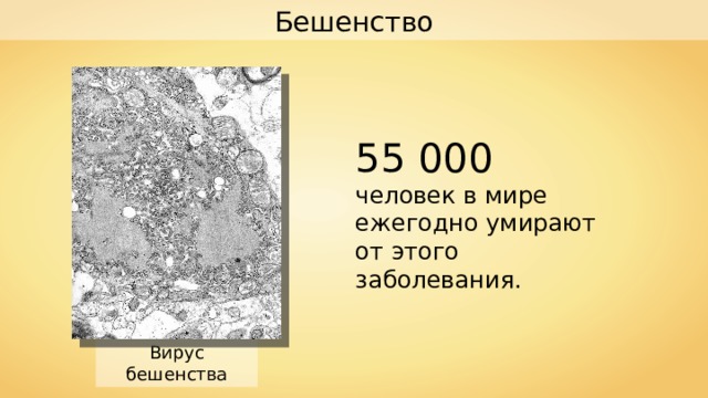 Бешенство 55 000 человек в мире ежегодно умирают от этого заболевания. Вирус бешенства 