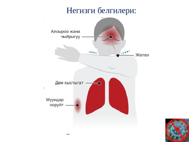 Негизги белгилери: 