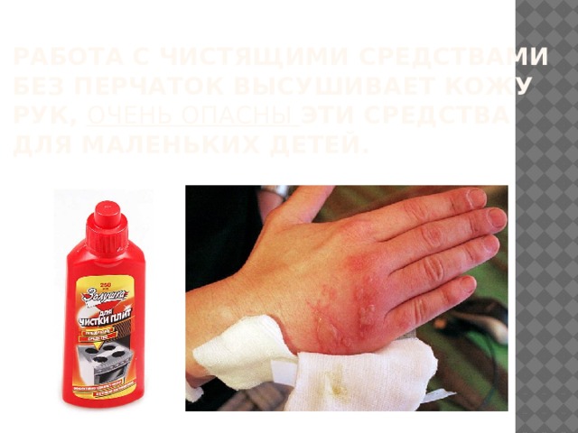 Работа с чистящими средствами без перчаток высушивает кожу рук, очень опасны эти средства для маленьких детей. 