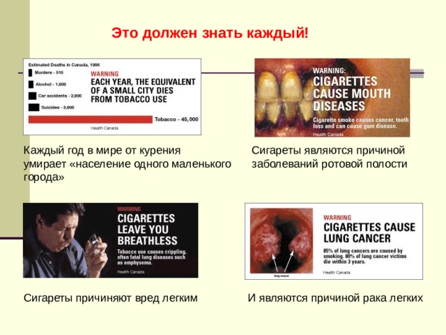  Это должен знать каждый! Каждый год в мире от курения умирает «население одного маленького города» Сигареты являются причиной заболеваний ротовой полости Сигареты причиняют вред легким И являются причиной рака легких 