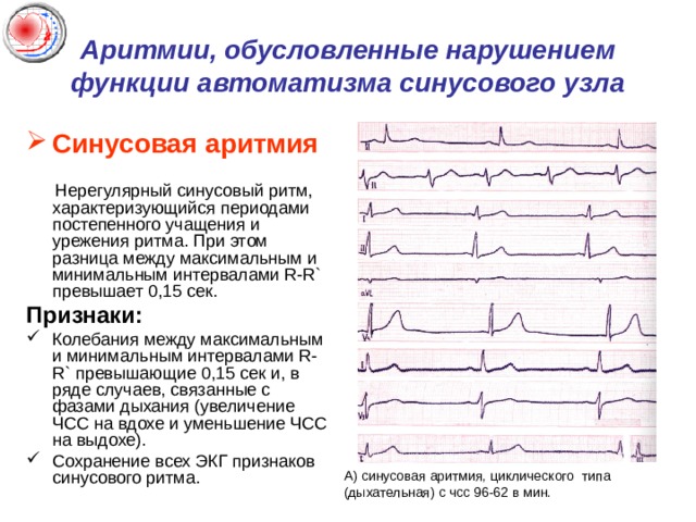 Cikl Ekg Dlya 6 Kursa