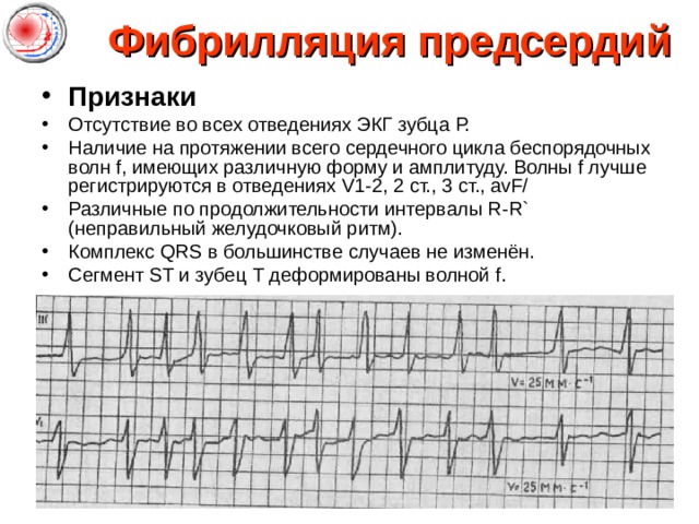 Cikl Ekg Dlya 6 Kursa