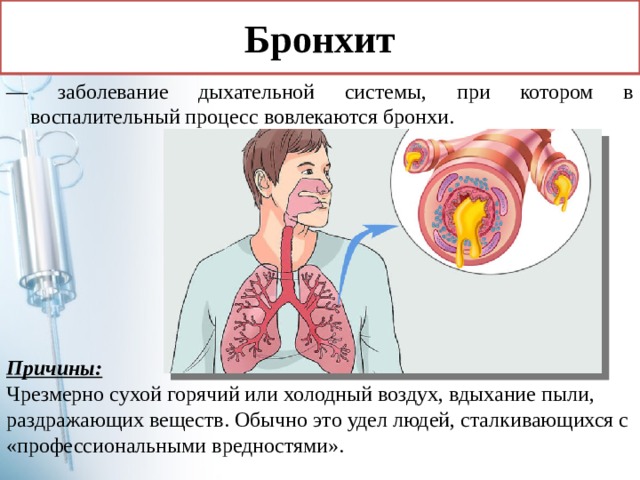 Основная причина бронхитов тест. Воспаление дыхательной системы.