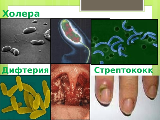 Холера в волге