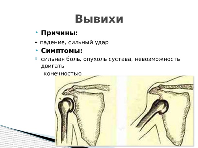 Припухлость сустава пальца руки. Боли в запястье – Сеть клиник «ОСТЕОМЕД» Тендовагинит пальцев: причины, симптомы и лечение Артрит пальцев рук: симптомы и лечение. Чем лечить артрит суставов.