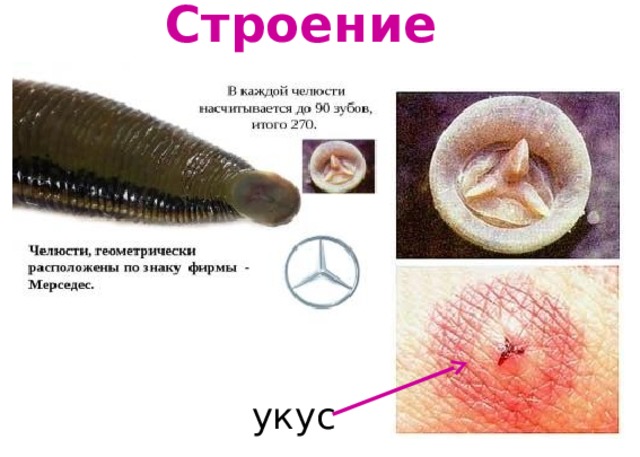 След от укуса пиявки фото