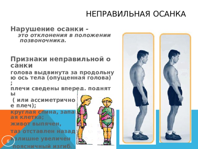 Подымать или поднимать. Признаки неправильной осанки. Нейтральное положение позвоночника. Голова вперед неправильная осанка. Осанка с выдвинутой вперед головой.