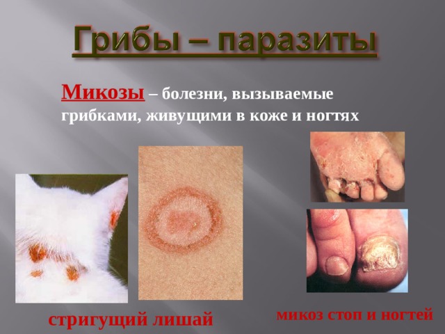 Микозы – болезни, вызываемые грибками, живущими в коже и ногтях микоз стоп и ногтей стригущий лишай 