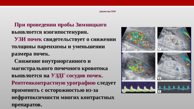 Диагностика ХПН   При проведении пробы Зимницкого выявляется изогипостенурия. УЗИ почек свидетельствует о снижении толщины паренхимы и уменьшении размера почек. Снижение внутриорганного и магистрального почечного кровотока выявляется на УЗДГ сосудов почек. Рентгенконтрастную урографию следует применять с осторожностью из-за нефротоксичности многих контрастных препаратов. 