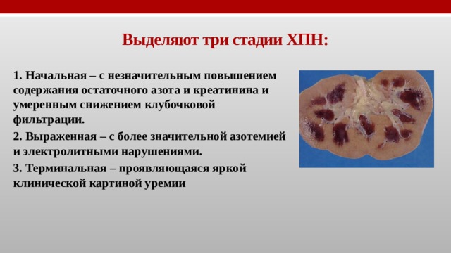Выделяют три стадии ХПН: 1. Начальная – с незначительным повышением содержания остаточного азота и креатинина и умеренным снижением клубочковой фильтрации. 2. Выраженная – с более значительной азотемией и электролитными нарушениями. 3. Терминальная – проявляющаяся яркой клинической картиной уремии 