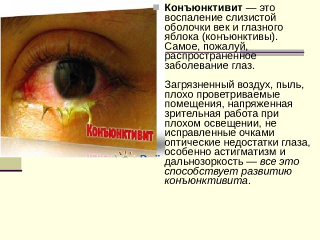 Конъюнктивит — это воспаление слизистой оболочки век и глазного яблока (конъюнктивы). Самое, пожалуй, распространенное заболевание глаз.   Загрязненный воздух, пыль, плохо проветриваемые помещения, напряженная зрительная работа при плохом освещении, не исправленные очками оптические недостатки глаза, особенно астигматизм и дальнозоркость — все это способствует развитию конъюнктивита . 