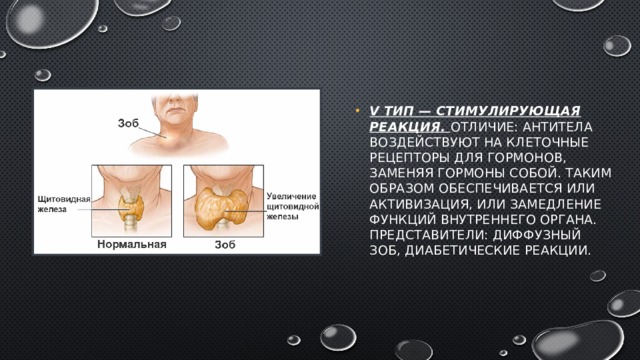 V тип — стимулирующая реакция. Отличие: антитела воздействуют на клеточные рецепторы для гормонов, заменяя гормоны собой. Таким образом обеспечивается или активизация, или замедление функций внутреннего органа. Представители: диффузный зоб, диабетические реакции. 