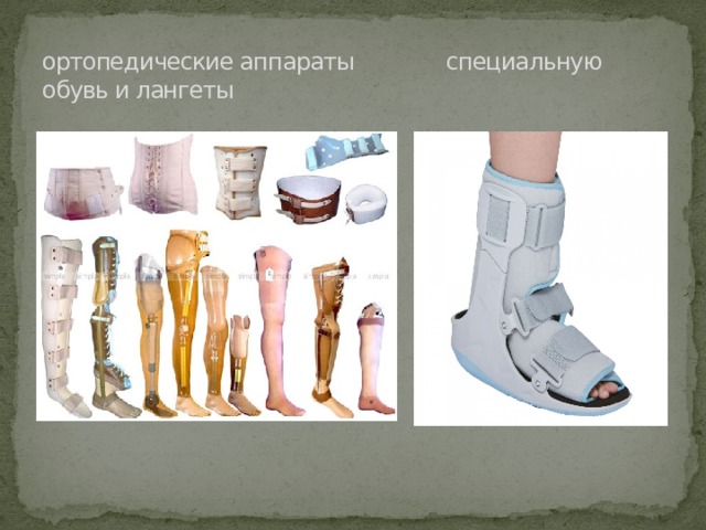 ортопедические аппараты специальную обувь и лангеты 