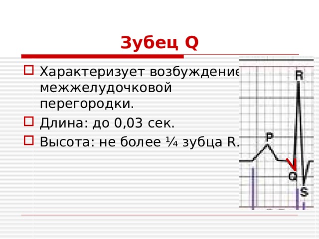 Зубец Q Характеризует возбуждение межжелудочковой перегородки. Длина: до 0,03 сек. Высота: не более ¼ зубца R . 