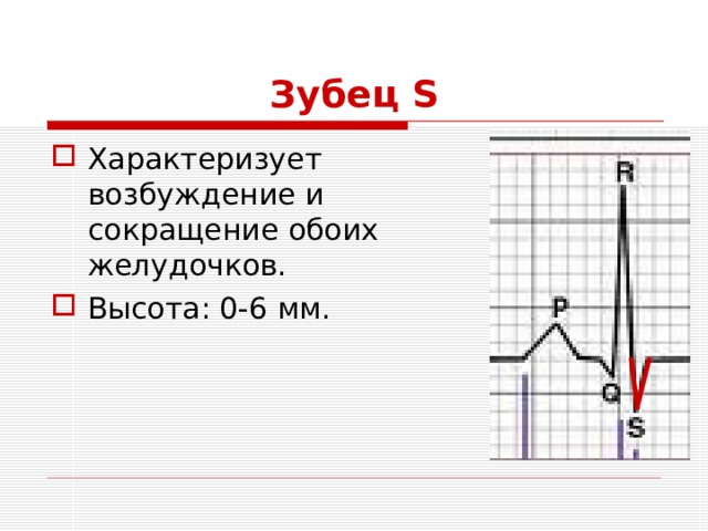 Зубец S Характеризует возбуждение и сокращение обоих желудочков. Высота: 0-6 мм. 
