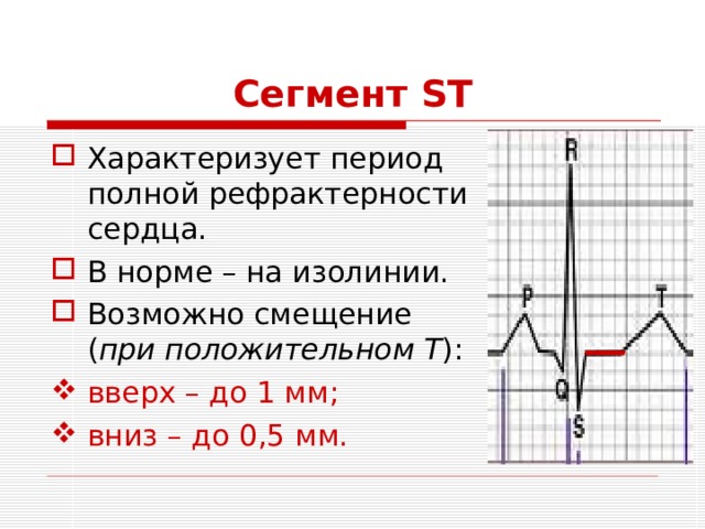 Сегмент ST Характеризует период полной рефрактерности сердца. В норме – на изолинии. Возможно смещение ( при положительном Т ): вверх – до 1 мм; вниз – до 0,5 мм. 