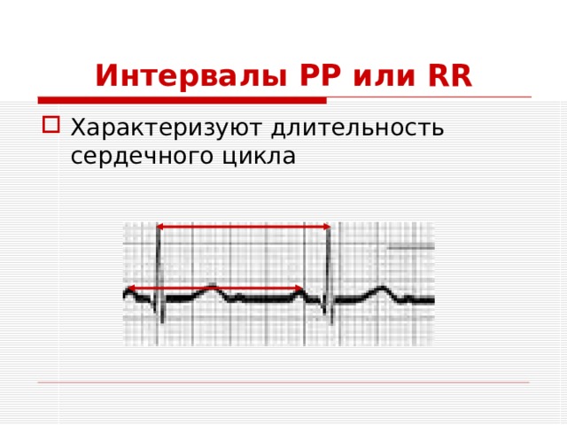 Интервалы PP или RR Характеризуют длительность сердечного цикла 