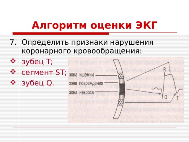 Алгоритм оценки ЭКГ Определить признаки нарушения коронарного кровообращения: зубец Т; сегмент ST ; зубец Q . 
