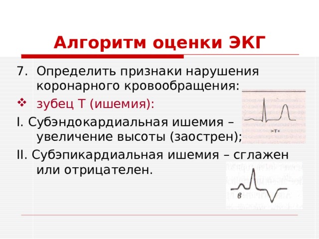 Алгоритм оценки ЭКГ Определить признаки нарушения коронарного кровообращения: зубец Т (ишемия): I . Субэндокардиальная ишемия – увеличение высоты (заострен); II . Субэпикардиальная ишемия – сглажен или отрицателен. 