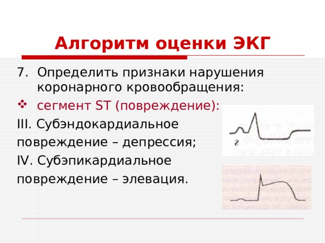 Алгоритм оценки ЭКГ Определить признаки нарушения коронарного кровообращения: сегмент ST (повреждение): III . Субэндокардиальное повреждение – депрессия; IV . Субэпикардиальное повреждение – элевация. 