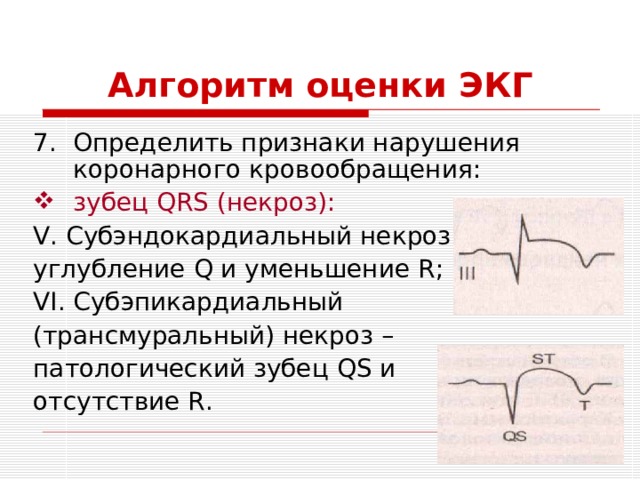 Алгоритм оценки ЭКГ Определить признаки нарушения коронарного кровообращения: зубец QRS (некроз): V . Субэндокардиальный некроз – углубление Q и уменьшение R ; VI . Субэпикардиальный (трансмуральный) некроз – патологический зубец QS и отсутствие R . 