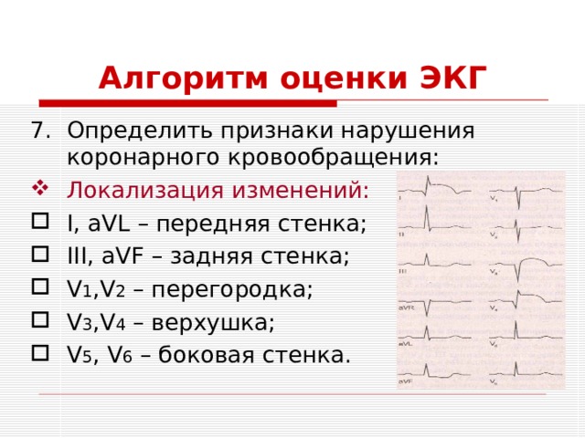 Алгоритм оценки ЭКГ Определить признаки нарушения коронарного кровообращения: Локализация изменений: I, aVL – передняя стенка; III, aVF – задняя стенка; V 1 ,V 2 – перегородка; V 3 ,V 4 – верхушка; V 5 , V 6 – боковая стенка. 