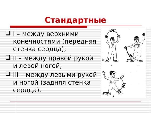 Стандартные I – между верхними конечностями (передняя стенка сердца); II – между правой рукой и левой ногой; III – между левыми рукой и ногой (задняя стенка сердца). 