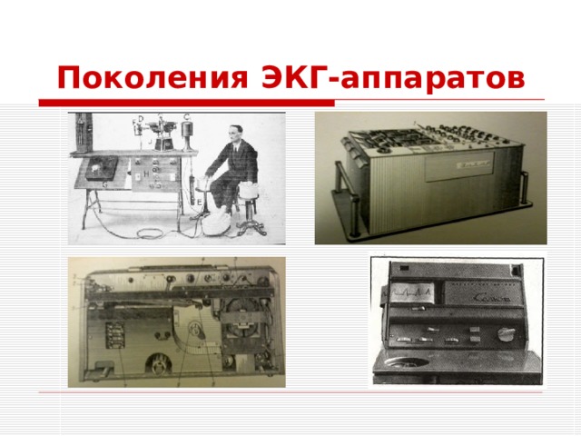 Поколения ЭКГ-аппаратов 