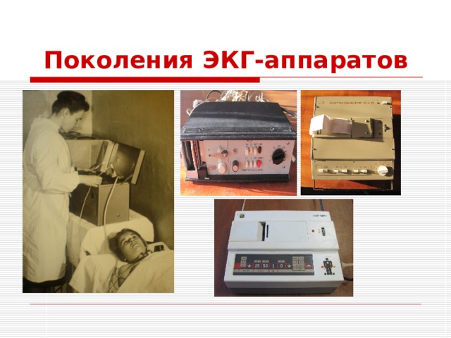 Поколения ЭКГ-аппаратов 