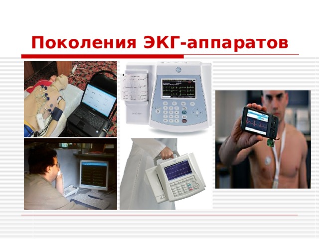 Поколения ЭКГ-аппаратов 