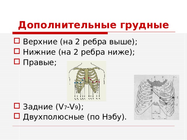 Дополнительные грудные Верхние (на 2 ребра выше); Нижние (на 2 ребра ниже); Правые;    Задние ( V 7 -V 9 ); Двухполюсные (по Нэбу). 