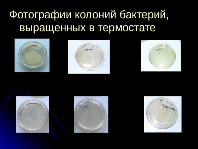 Фотографии колоний бактерий, выращенных в термостате  
