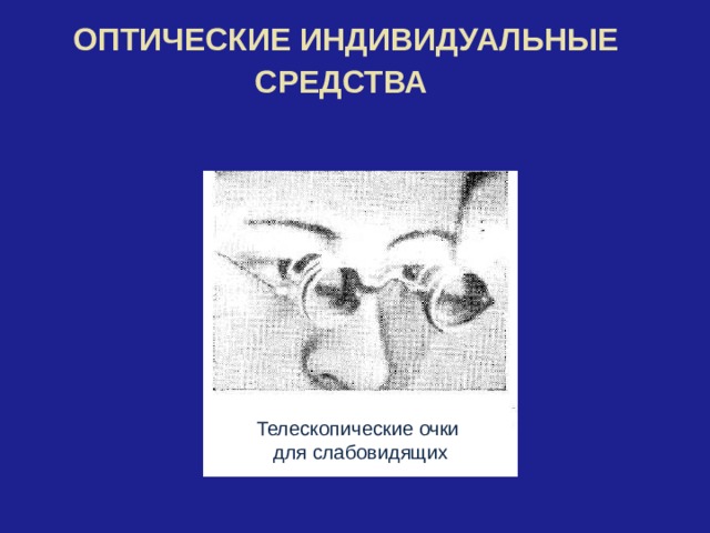 ОПТИЧЕСКИЕ ИНДИВИДУАЛЬНЫЕ СРЕДСТВА  Телескопические очки для слабовидящих 