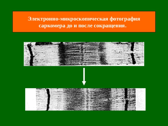 Электронно-микроскопическая фотография саркомера до и после сокращения . 