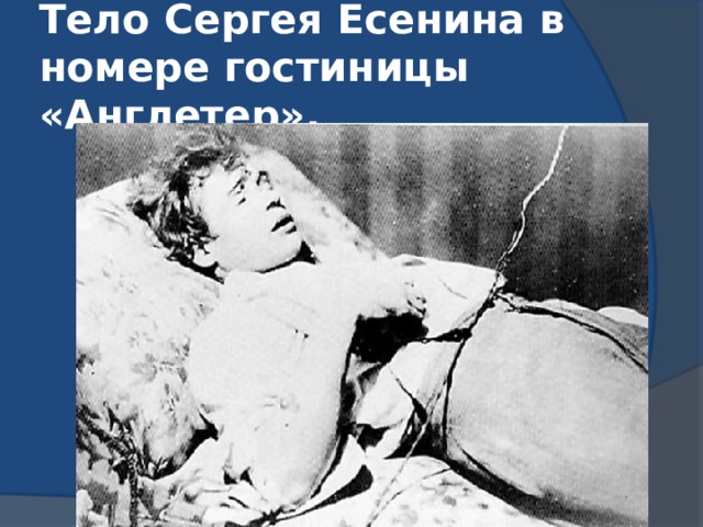 Тело Сергея Есенина в номере гостиницы «Англетер». 