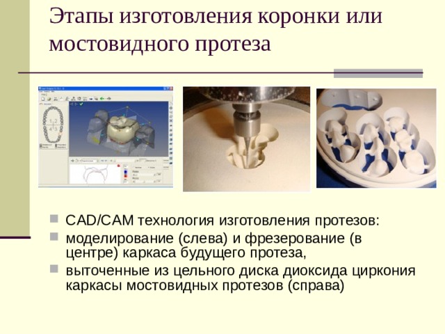 Процесс изготовления коронок. Безметалловые мостовидные протезы CAD cam реферат.