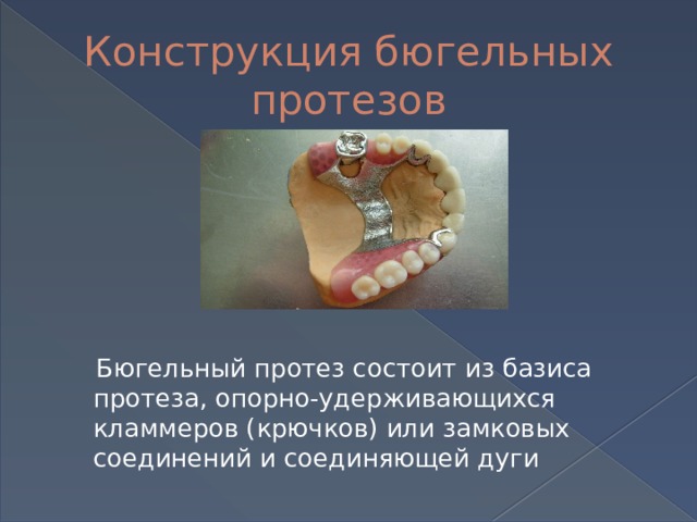 Конструкция бюгельных протезов  Бюгельный протез состоит из базиса протеза, опорно-удерживающихся кламмеров (крючков) или замковых соединений и соединяющей дуги 