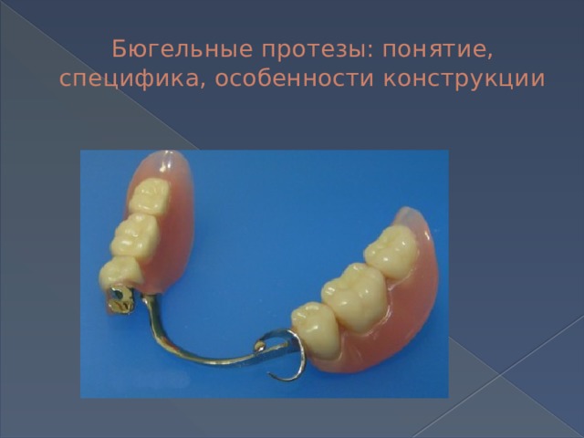 Бюгельные протезы: понятие, специфика, особенности конструкции 