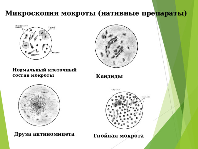 Состав мокроты