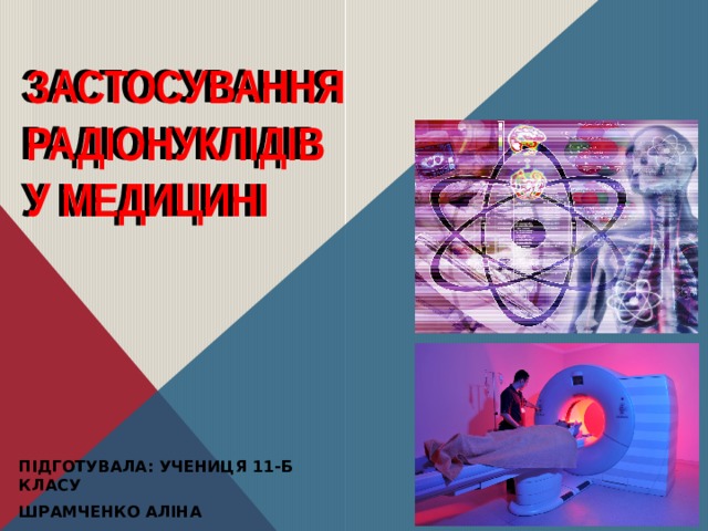 ЗАСТОСУВАННЯ РАДІОНУКЛІДІВ У МЕДИЦИНІ Застосування  радіонуклідів  у медицині Підготувала: учениця 11-Б класу Шрамченко Аліна 