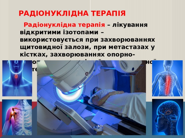 Радіонуклідна терапія  Радіонуклідна терапія – лікування відкритими ізотопами –використовується при захворюваннях щитовидної залози, при метастазах у кістках, захворюваннях опорно-рухового апарату і нейроендокринної системи. 