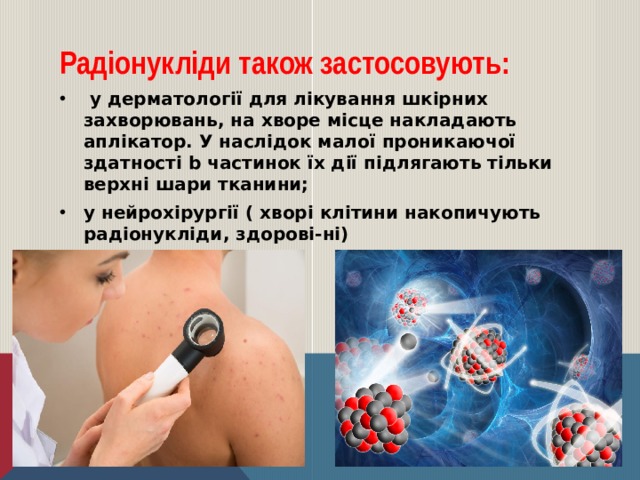 Радіонукліди також застосовують:  у дерматології для лікування шкірних захворювань, на хворе місце накладають аплікатор. У наслідок малої проникаючої здатності b частинок їх дії підлягають тільки верхні шари тканини; у нейрохірургії ( хворі клітини накопичують радіонукліди, здорові-ні)   